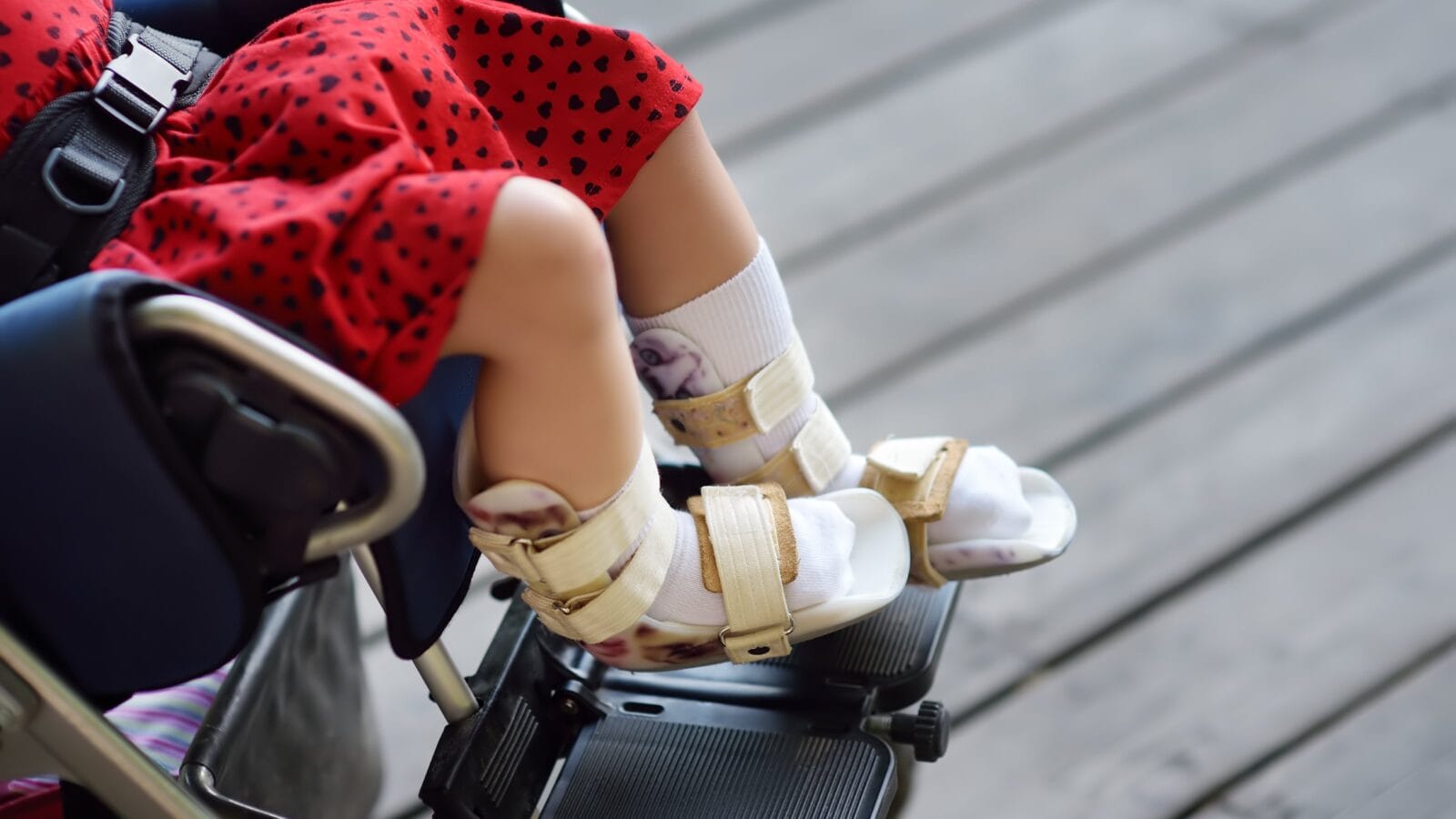 Disabled girl sitting in wheelchair.